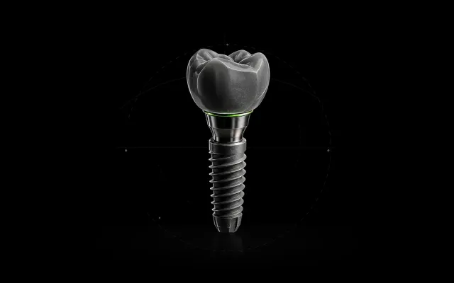 Dental implant model with crown