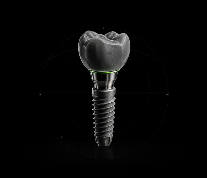 Dental implant model with crown